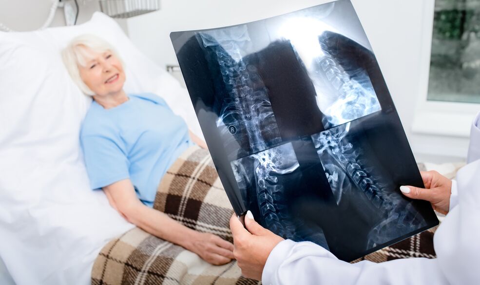 dijagnoza osteohondroze