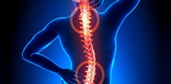 simptomi bolova u leđima