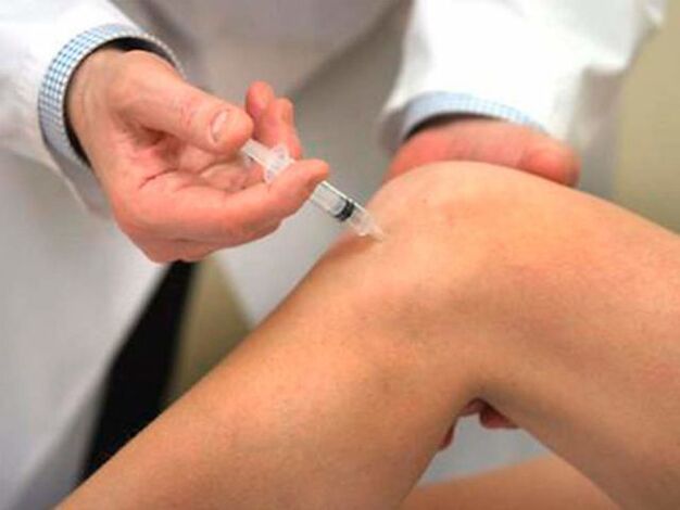 Intraartikularna injekcija jedan je od najprogresivnijih oblika liječenja artroze zgloba koljena. 