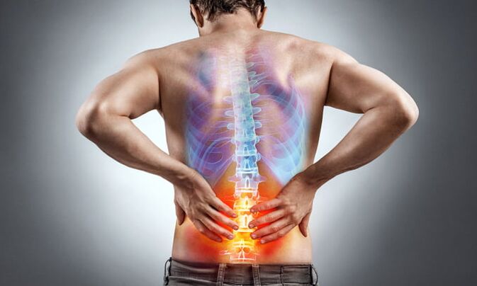 uzroci bolova u donjem dijelu leđa