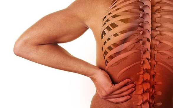 Bol je glavni neurološki simptom spinalne osteohondroze