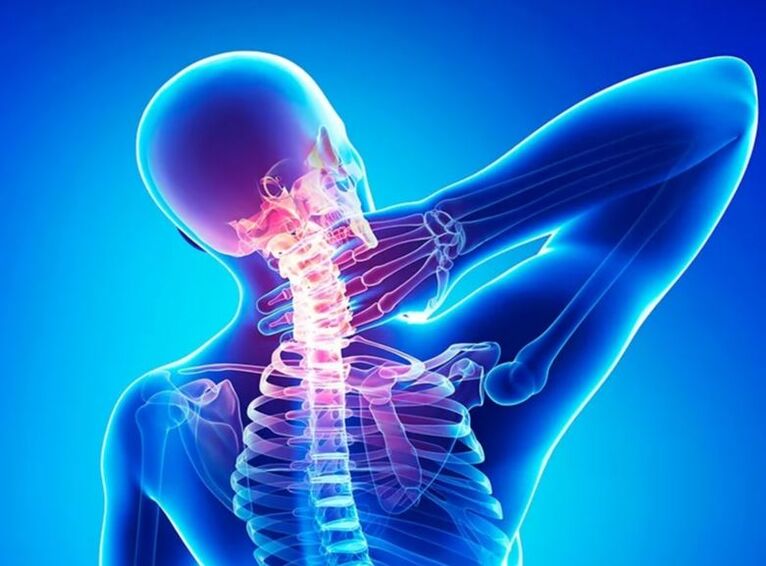Osteohondroza grlića maternice