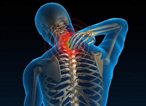 bol u vratnoj kralježnici s osteohondrozo